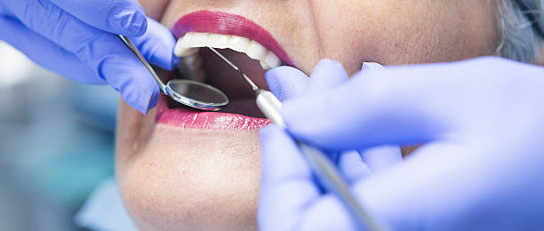 Best Knocked-Out Tooth Emergency  in Chelsea, AL